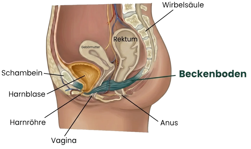 Skizze einer Zystozele (Blasensenkung)