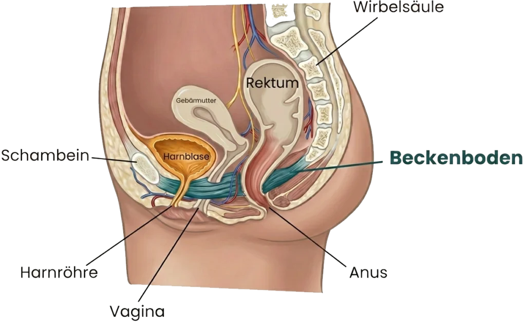 Skizze einer Rektozele (Darmsenkung)